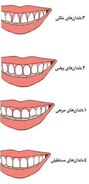 آنالیز فرم دندان